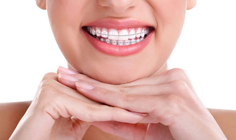 تفاوت ارتودنتیست با دندانپزشک