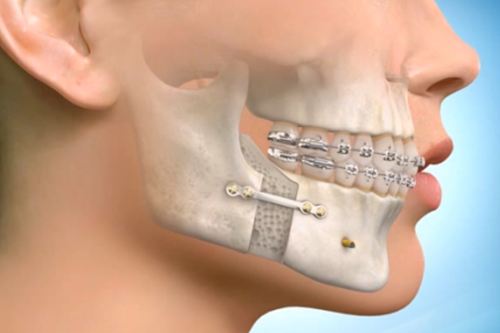 ارتودنسی دندان - ارتومرکز